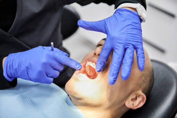 Best Emergency Wisdom Tooth Extraction in Lamoni, IA